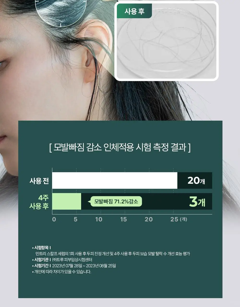[올영1위 두피앰플] 민트리 스칼프 세럼 20ml 상세페이지 12